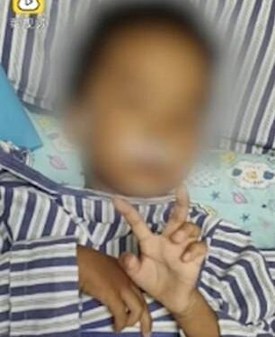 زي القطط بـ 7 أرواح .. طفل يسقط من الدور الـ 18 دون أن يموت